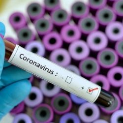 فرنسا تعلن نتائج اختبار دواء كورونا “المحتمل” خلال أيام