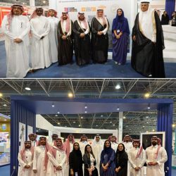 بدء عملية فصل التوأم السيامي التنزاني “حسن وحسين”