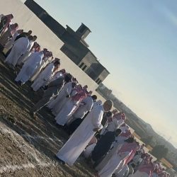 نجاح فصل التوأم السيامي التنزاني ” حسن وحسين ” بعد عملية جراحية معقدة استغرقت 16 ساعة